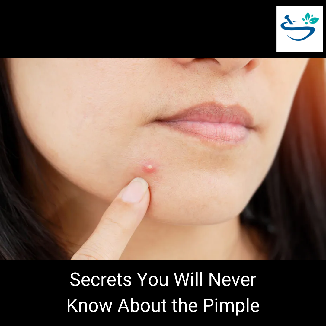 Secrets You Will Never Know About the Pimple