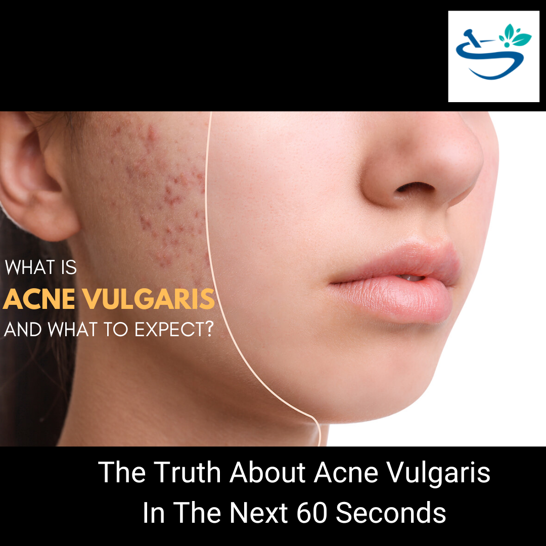 The Truth About Acne Vulgaris In The Next 60 Seconds