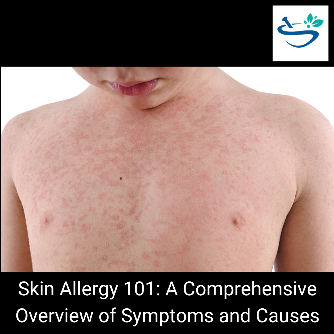 Relieve Skin Allergy Symptoms with Our Effective Solutions