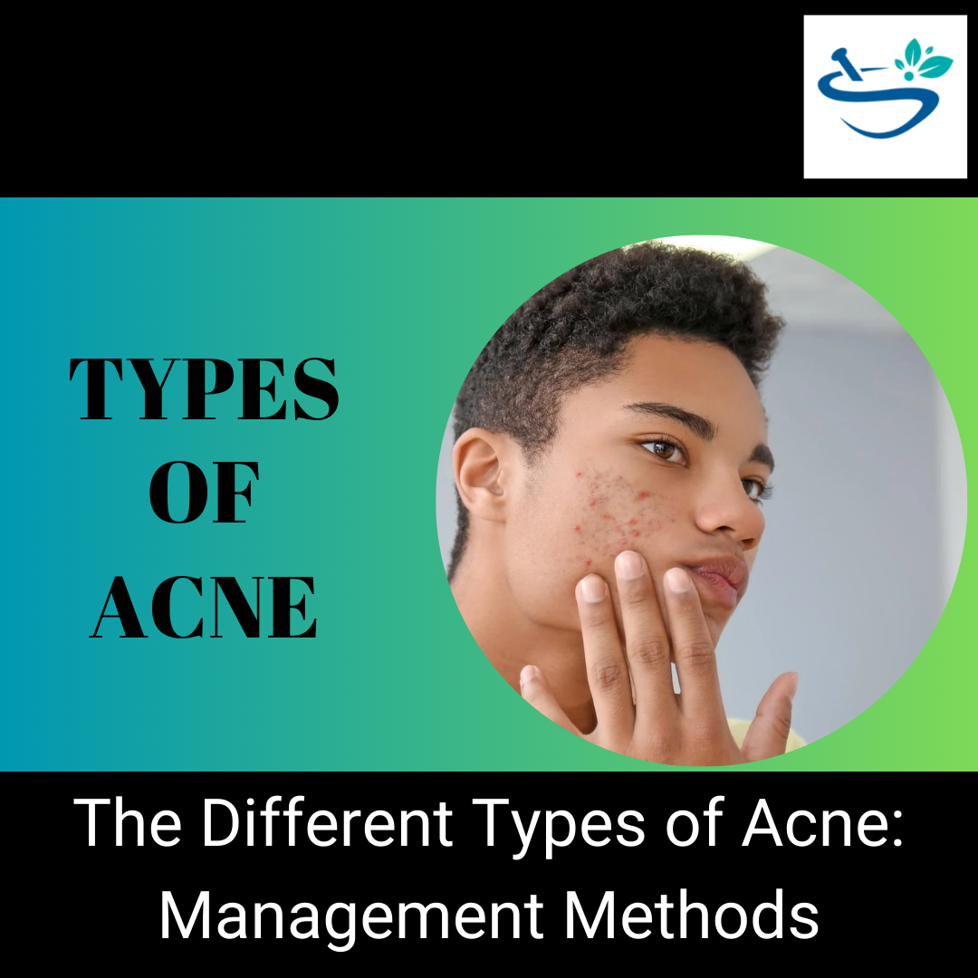 Discover the Different Types of Acne and How to Treat Them