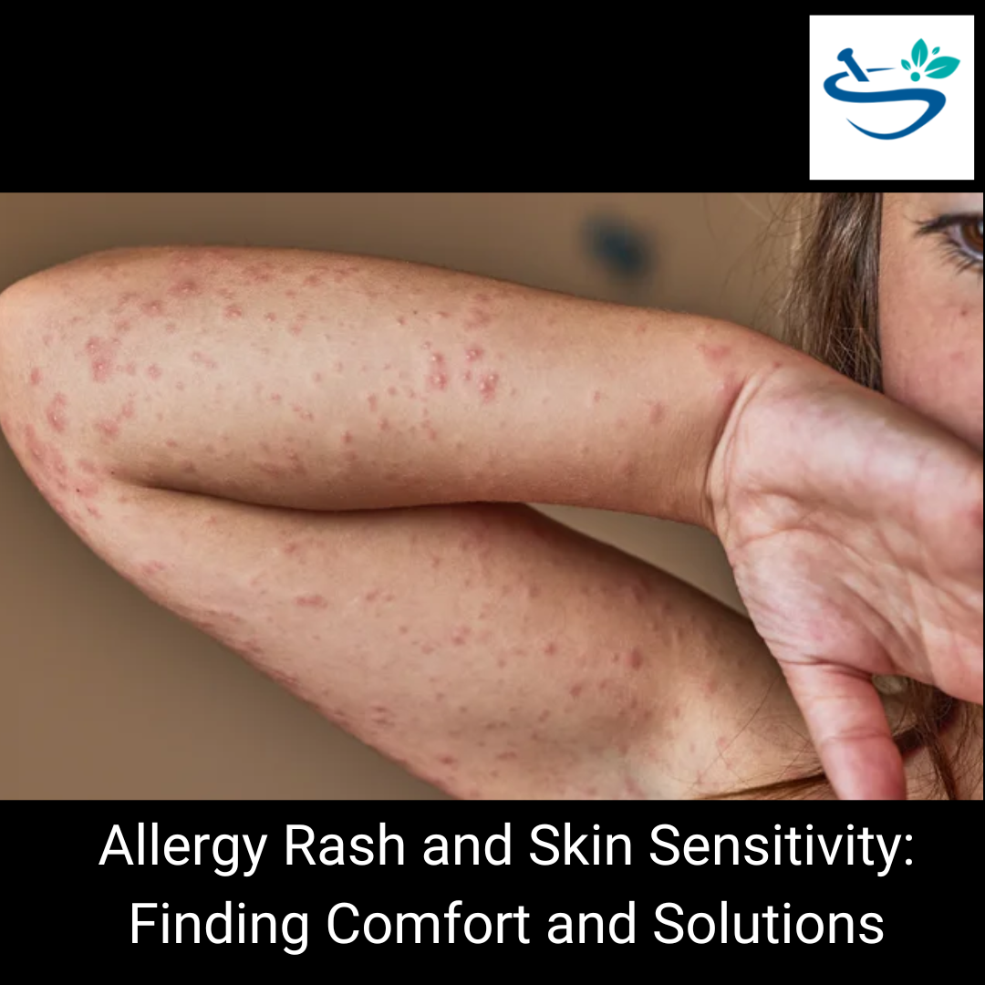 Relieve Your Allergy Rash with Effective and Gentle Care