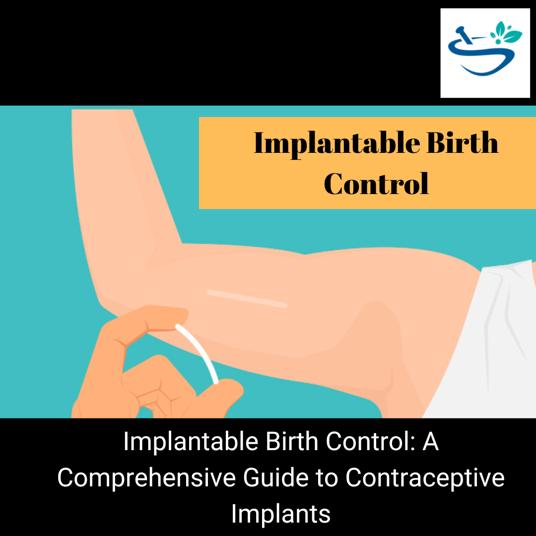 Safe and Effective Implantable Birth Control Options for Hassle-Free Family Planning