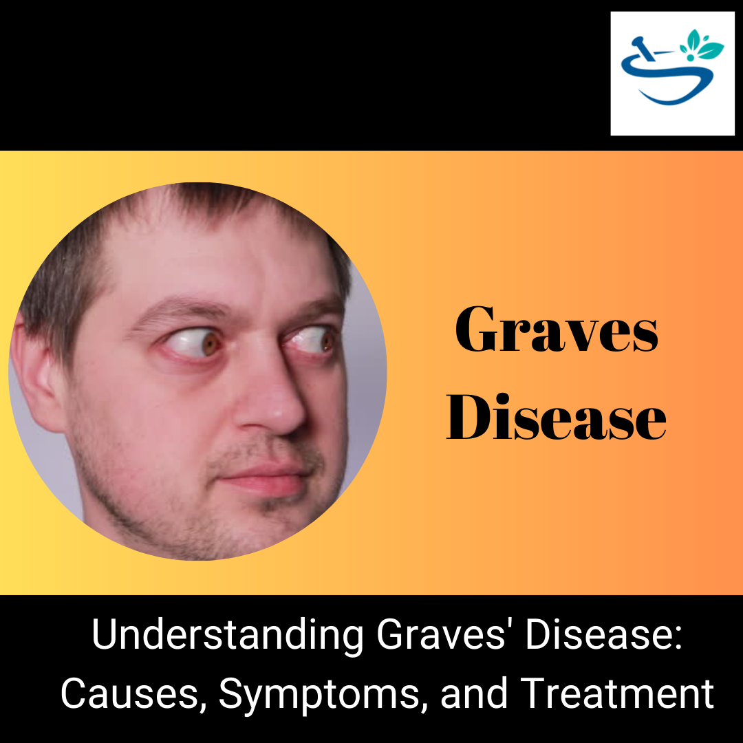 Effective Strategies for Managing Graves Disease: Expert Tips and Support