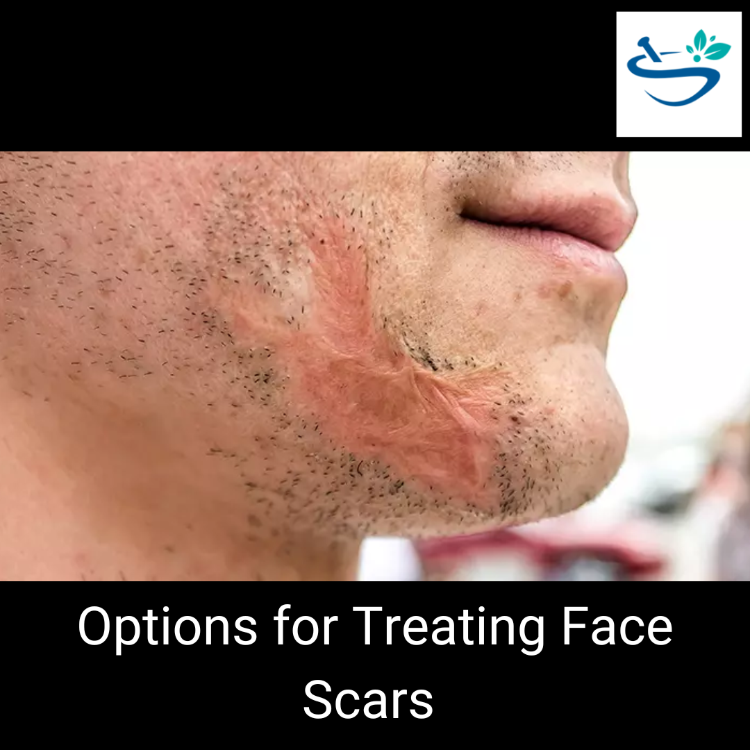 Say Goodbye to Face Scars with Our Effective Scar Treatment Solutions