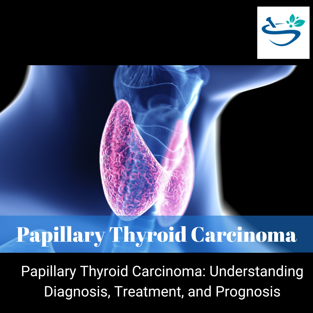 Papillary Thyroid Carcinoma: Cutting-Edge Treatment Options