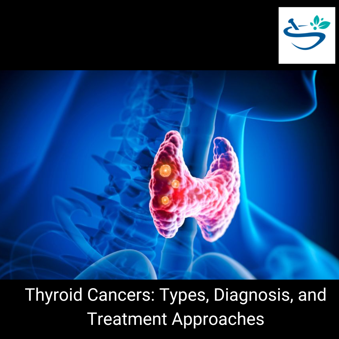 Thyroid Cancers Patients: Resources, Treatment, and Support
