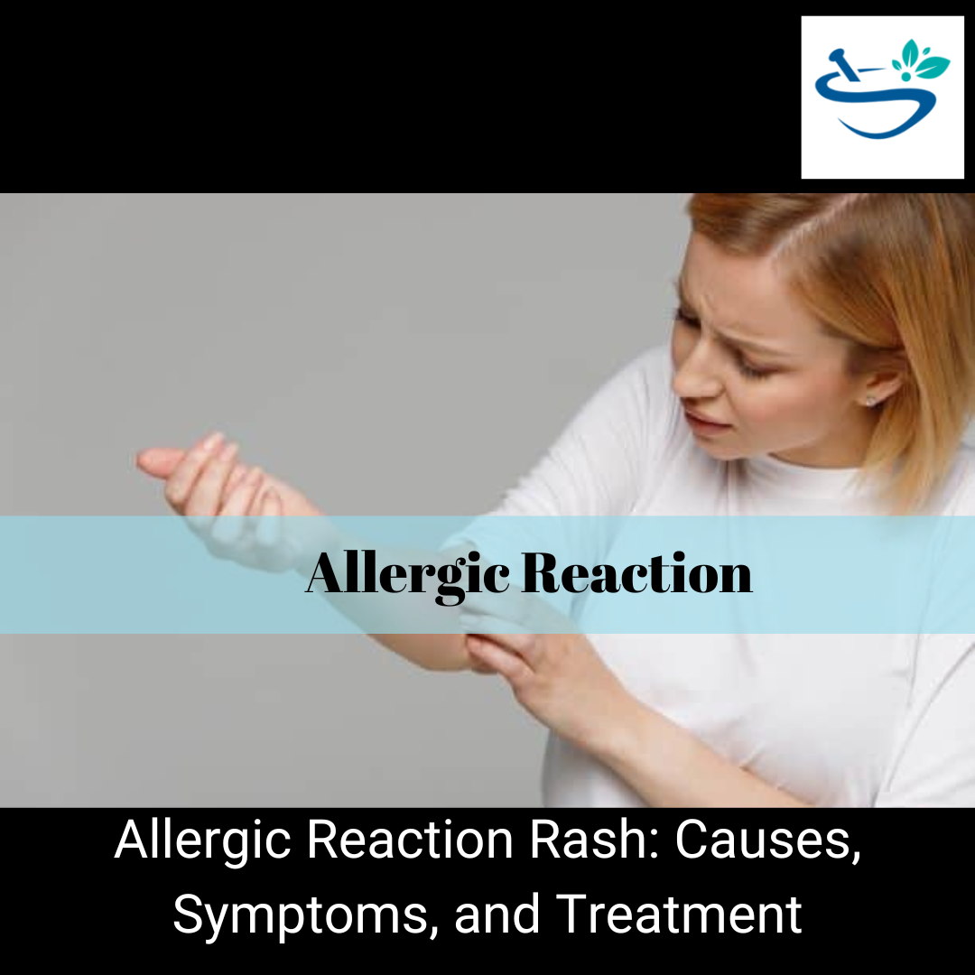 Allergic Reaction Rash Causes Symptoms And Treatment