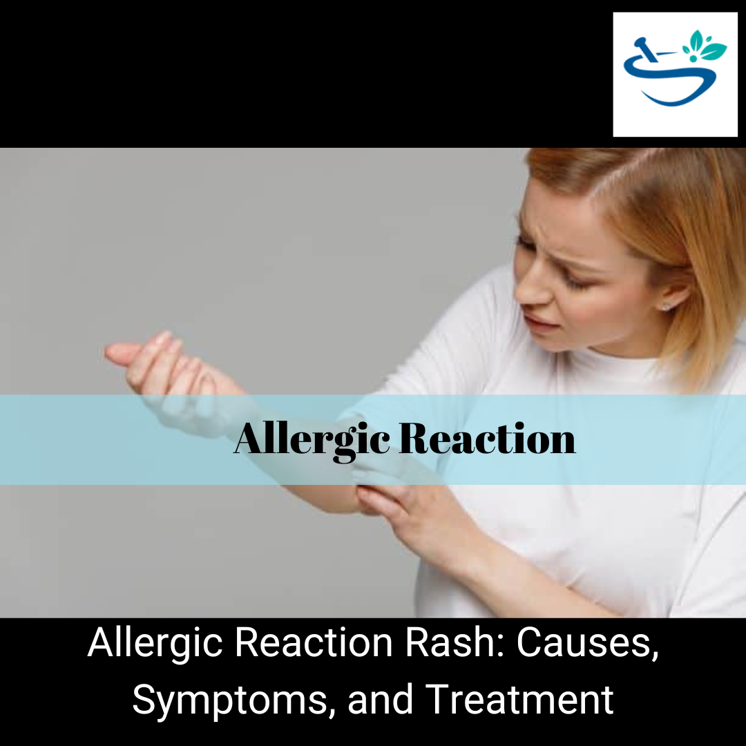 Allergic Reaction Rash: Causes, Symptoms, and Treatment